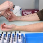 Testul Alergologic Faber - Clinica Medicum